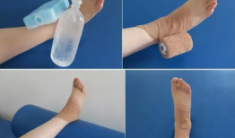 肘关节康复训练视频,全方位指导，轻松恢复运动能力