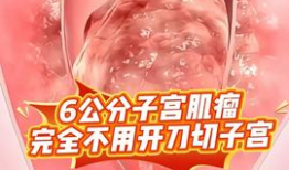 痔疮手术视频,直观了解手术步骤与细节